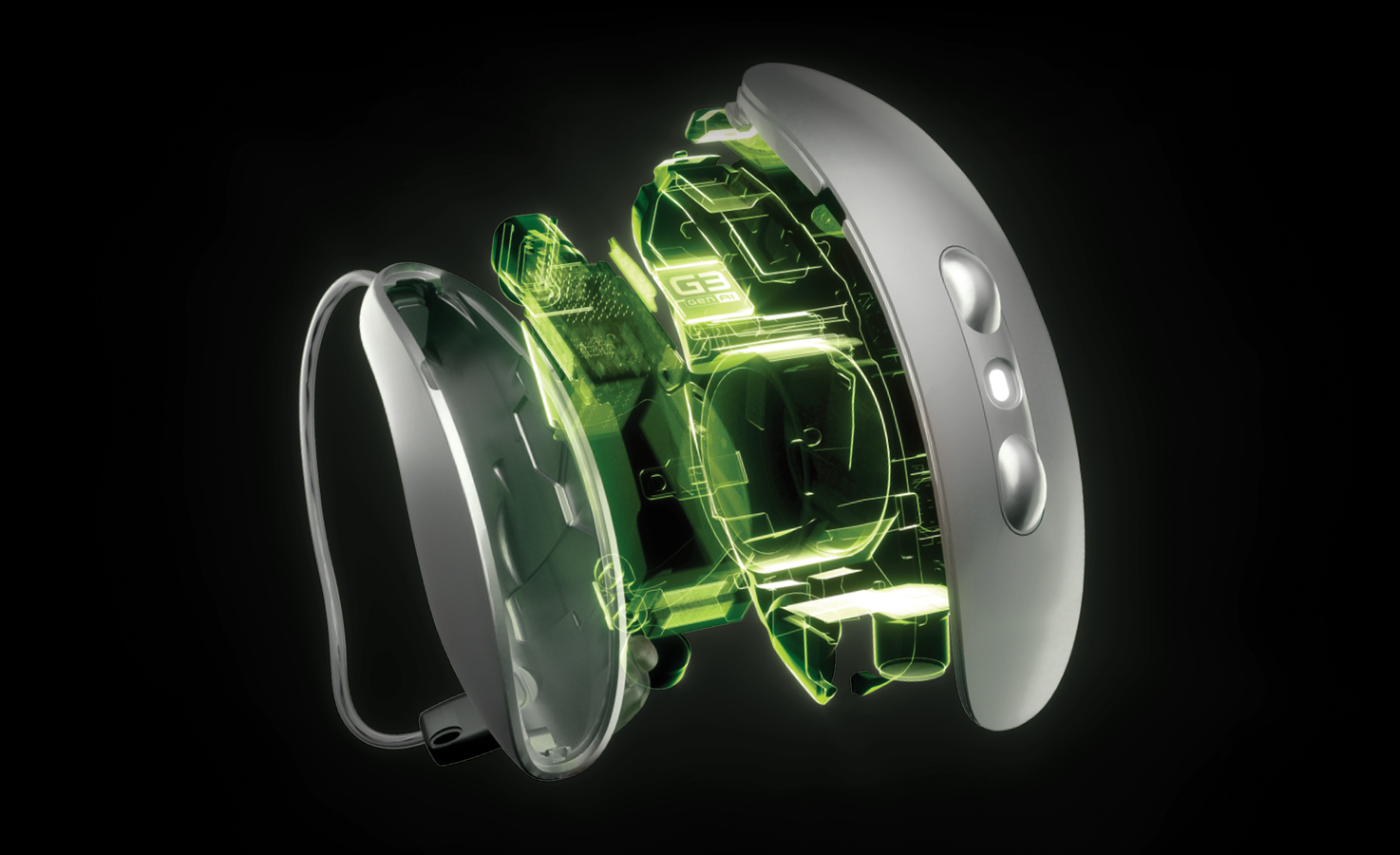 Aris AI hearing aid.