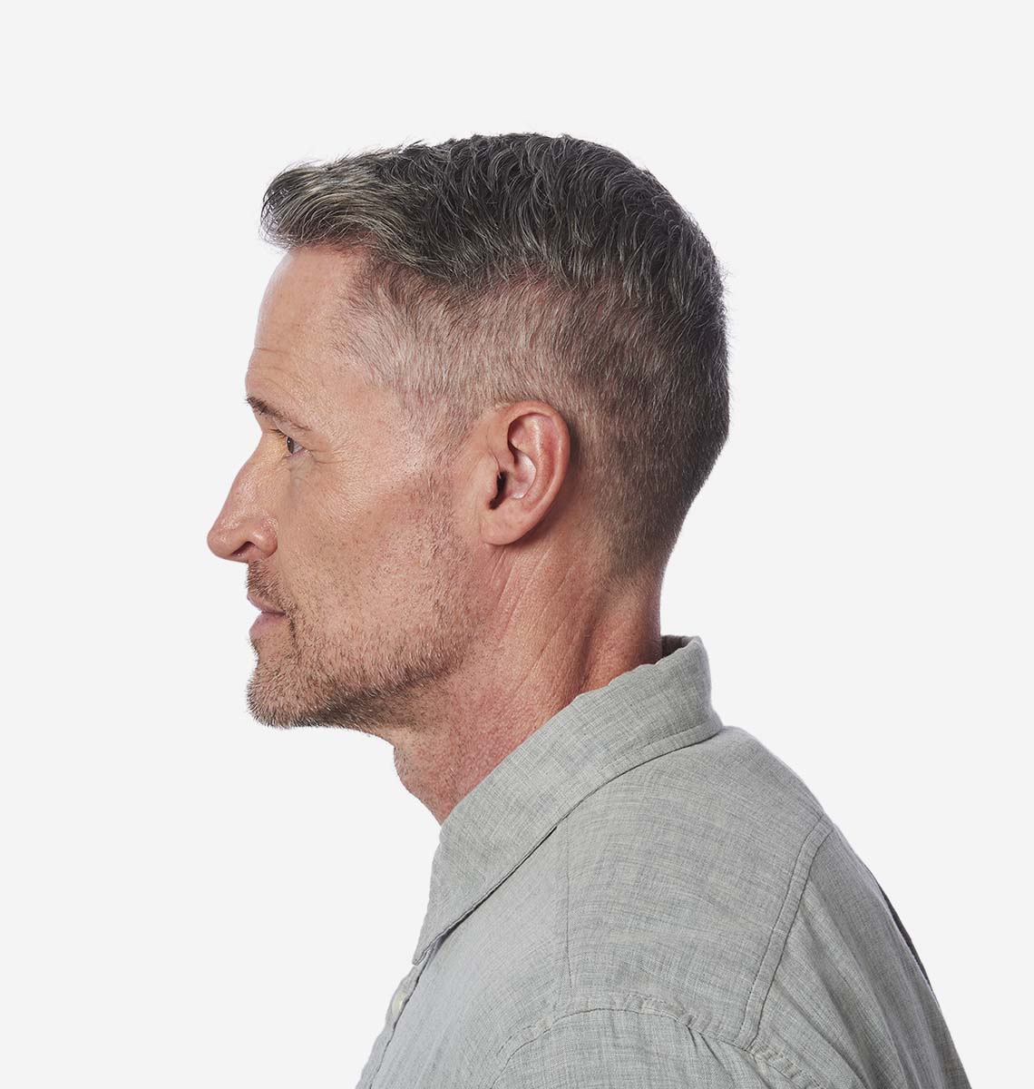 Products: Aris AI RIC RT Custom Cased | AudibelPro